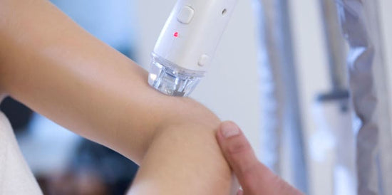 Laser Treatment For Hair Removal Full Arm Area 10 session (male & female)
