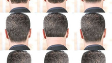 Load image into Gallery viewer, Laser full neck 10 session
