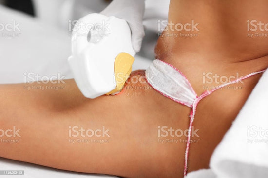 Laser Treatment For Hair Removal Bikini (sides & top) Area 10 session (male and female)